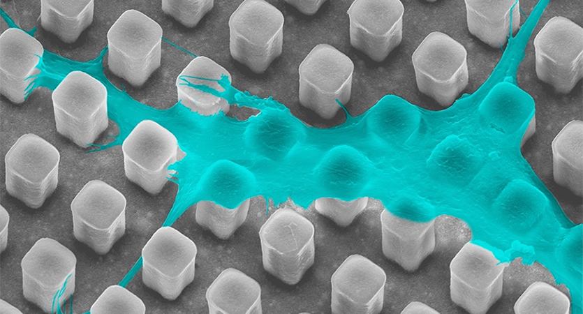When a cell’s nucleus changes shape — a process called nuclear deformation — the body boosts its ability to regenerate bone tissue, offering potential benefits for patients recovering from fractures or undergoing bone graft procedures.