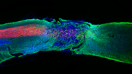‘Dancing Molecules’ Treatment Receives FDA Orphan Drug Designation